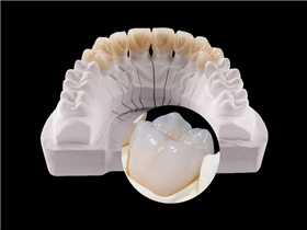 氧化锆全瓷冠/桥