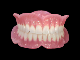 Full arch acrylic denture