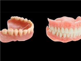 CAD  milling （half/full arch）