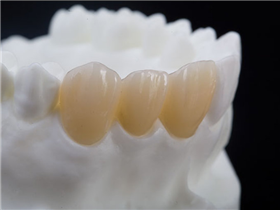 氧化锆全锆冠/桥