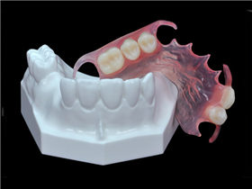 Valplast/Flexible  partial  denture